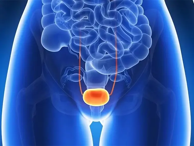 Bladder Cancer