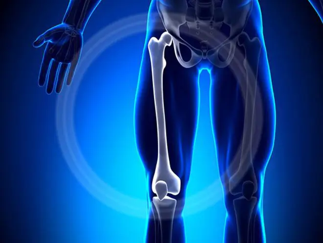 Bone Cancer