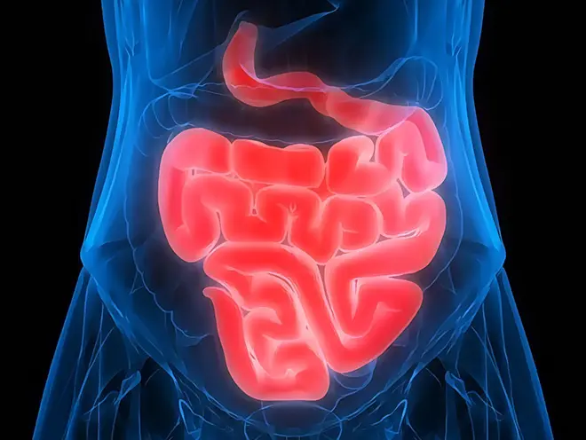Duodenal Cancer