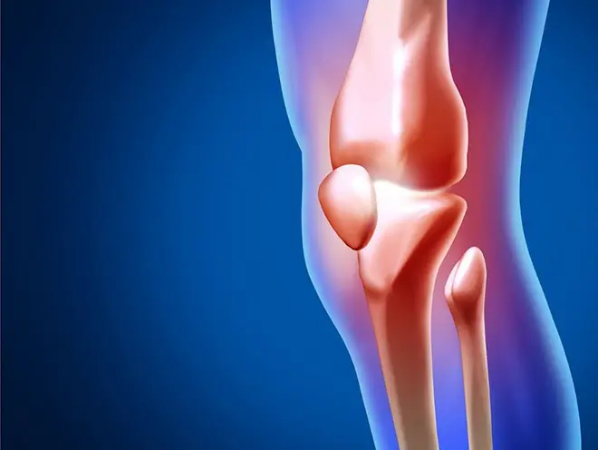 Soft Tissue Cancer