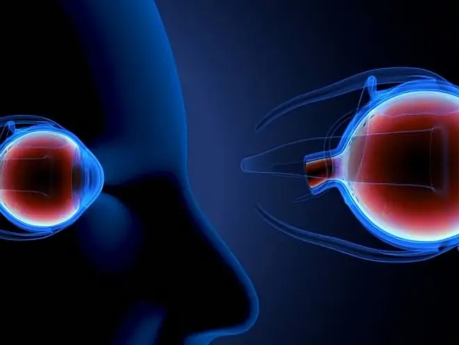 eye cancer