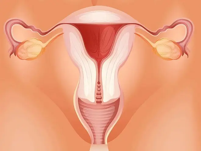 vaginal cancer