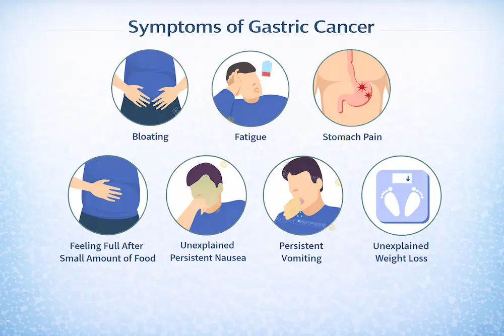 symptoms-of-gastric-cancer